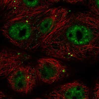 Immunocytochemistry/Immunofluorescence: CCDC92 Antibody [NBP2-56862] - Staining of human cell line MCF7 shows localization to nucleoplasm & centrosome. Antibody staining is shown in green. 