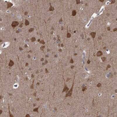 Immunohistochemistry-Paraffin: CCDC92 Antibody [NBP1-82119] - Staining of human cerebral cortex shows strong cytoplasmic positivity in neuronal cells and moderate in neuropil.