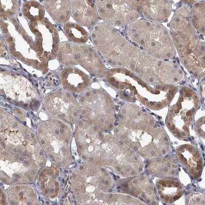 Immunohistochemistry-Paraffin: CCDC92 Antibody [NBP1-82119] - Staining of human kidney shows moderate cytoplasmic positivity in cells in tubules.