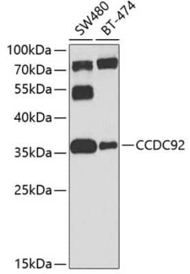 Western Blot: CCDC92 Antibody [NBP2-92829] - Analysis of extracts of various cell lines, using CCDC92 at 1:1000 dilution.Secondary antibody: HRP Goat Anti-Rabbit IgG (H+L) at 1:10000 dilution.Lysates/proteins: 25ug per lane.Blocking buffer: 3% nonfat dry milk in TBST.Detection: ECL Basic Kit .Exposure time: 60s.