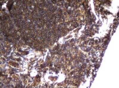 Immunohistochemistry: CCDC93 Antibody (OTI6E11) - Azide and BSA Free [NBP2-71963] - Analysis of Human lymph node tissue.