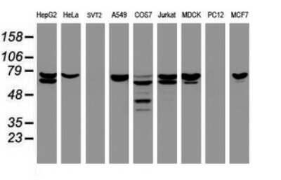Western Blot: CCDC93 Antibody (OTI6E11) - Azide and BSA Free [NBP2-71963] - Analysis of extracts (35ug) from 9 different cell lines (HepG2: human; HeLa: human; SVT2: mouse; A549: human; COS7: monkey; Jurkat: human; MDCK: canine; PC12: rat; MCF7: human).