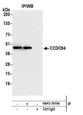 Immunoprecipitation: CCDC94 Antibody [NBP2-78706] - Detection of human CCDC94 by western blot of immunoprecipitates. Samples: Whole cell lysate (1.0 mg per IP reaction; 20% of IP loaded) from HEK293T cells prepared using NETN lysis buffer. Antibodies: this antibody was used for IP at 100 ul per reaction. For blotting immunoprecipitated CCDC94, this antibody was used at 1:1000. Detection: Chemiluminescence with an exposure time of 3 minutes.
