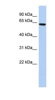 Western Blot: CCDC96 Antibody [NBP1-70489] - Titration: 0.2-1 ug/ml, Positive Control: HepG2 cell lysate.