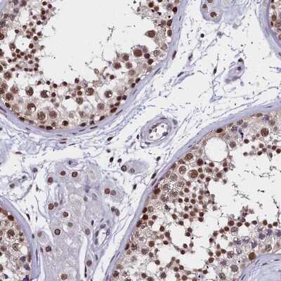 Immunohistochemistry-Paraffin: CCDC97 Antibody [NBP1-91767] - Staining of human testis shows strong nuclear positivity in cells in seminiferus ducts and nuclear membrane staining in Leydig cells.