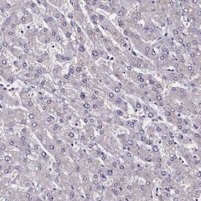 Immunohistochemistry-Paraffin: CCDC97 Antibody [NBP1-91767] - Staining of human liver shows low expression as expected.
