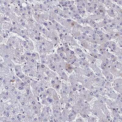 Immunohistochemistry-Paraffin: CCDC97 Antibody [NBP1-91768] - Staining of human liver shows low expression as expected.