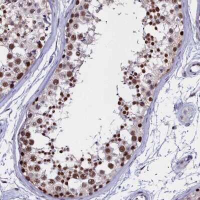 Immunohistochemistry-Paraffin: CCDC97 Antibody [NBP1-91768] - Staining of human testis shows high expression.