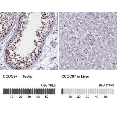 Immunohistochemistry-Paraffin: CCDC97 Antibody [NBP1-91768] - Staining in human testis and liver tissues using anti-CCDC97 antibody. Corresponding CCDC97 RNA-seq data are presented for the same tissues.