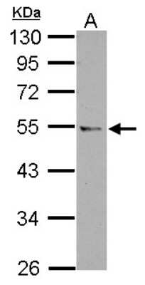 Western Blot: CCDC97 Antibody [NBP2-15758] - Sample (30 ug of whole cell lysate) A: Jurkat 10% SDS PAGE gel, diluted at 1:500.