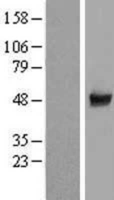 Western Blot: CCDC97 Overexpression Lysate (Adult Normal) [NBL1-08835] Left-Empty vector transfected control cell lysate (HEK293 cell lysate); Right -Over-expression Lysate for CCDC97.