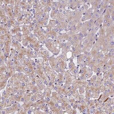 <b>Orthogonal Strategies Validation. </b>Immunohistochemistry-Paraffin: CCDC99 Antibody [NBP2-47517] - Staining of human liver shows low expression as expected.