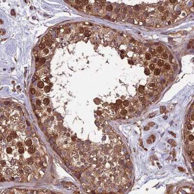 Immunohistochemistry-Paraffin: CCDC99 Antibody [NBP2-47517] - Staining of human testis shows high expression.