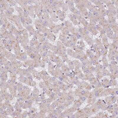 Immunohistochemistry-Paraffin: CCDC99 Antibody [NBP2-47518] - Staining of human liver shows low expression as expected.