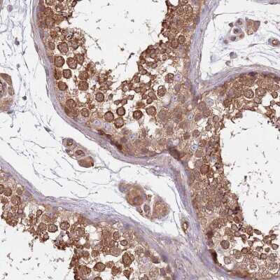 Immunohistochemistry-Paraffin: CCDC99 Antibody [NBP2-47518] - Staining of human testis shows high expression.