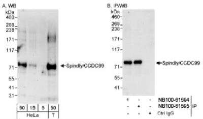 Western Blot: CCDC99 Antibody [NB100-61594] - Detection of Human Spindly/CCDC99 on HeLa whole cell lysate using NB100-61594. Spindly/CCDC99 was also immunoprecipitated by rabbit anti-Spindly/CCDC99 antibody NB100-61595.