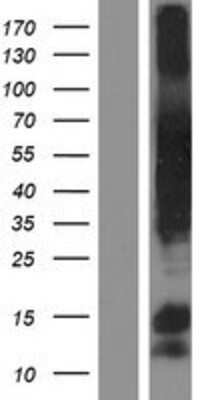 Western Blot: CCDC99 Overexpression Lysate (Adult Normal) [NBP2-06925] Left-Empty vector transfected control cell lysate (HEK293 cell lysate); Right -Over-expression Lysate for CCDC99.