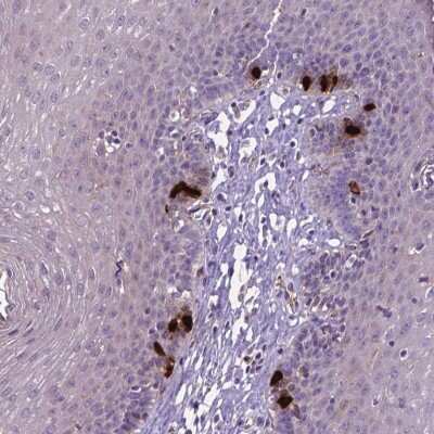 Immunohistochemistry-Paraffin: CCER2 Antibody [NBP2-49614] - Staining of human esophagus shows strong cytoplasmic and nuclear positivity in a subset of cells.