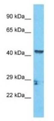 Western Blot: CCHC-type Zinc Finger Antibody [NBP3-09928] - Western blot analysis of CCHC-type Zinc Finger in Human HCT15 Whole Cell . Antibody dilution at 1ug/ml