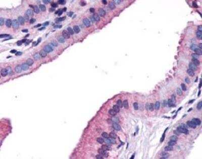 Immunohistochemistry-Paraffin: CCK-A R Antibody [NLS3293] - Analysis of anti-CCKAR / CCK1R antibody with human gall bladder, epithelium.