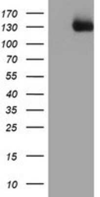 Western Blot: PTK7/CCK4 Antibody (OTI2E7) [NBP2-01486] -  HEK293T cells were transfected with the pCMV6-ENTRY control (Left lane) or pCMV6-ENTRY CCK4 (Right lane) cDNA for 48 hrs and lysed. Equivalent amounts of cell lysates (5 ug per lane) were separated by SDS-PAGE and immunoblotted with anti-CCK4.