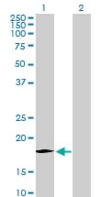 Western Blot: CCL11/Eotaxin Antibody [H00006356-D01P] - Analysis of CCL11 expression in transfected 293T cell line by CCL11 polyclonal antibody.Lane 1: CCL11 transfected lysate(10.70 KDa).Lane 2: Non-transfected lysate.