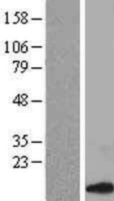 Western Blot: CCL14 Overexpression Lysate (Adult Normal) [NBL1-08845] Left-Empty vector transfected control cell lysate (HEK293 cell lysate); Right -Over-expression Lysate for CCL14.