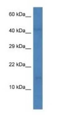 Western Blot: CCL16/HCC-4/LEC Antibody [NBP1-74186] - Titration: 1.0 ug/ml Positive Control: 721_B Whole Cell.