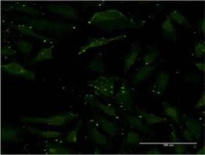 Immunocytochemistry/Immunofluorescence: CCL17/TARC Antibody (1F11) [H00006361-M02] - Analysis of monoclonal antibody to CCL17 on HeLa cell . Antibody concentration 10 ug/ml.