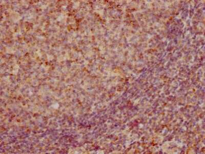 Immunohistochemistry: CCL19/MIP-3 beta Antibody (3A12) [NBP3-15143] - IHC image of CCL19/MIP-3 beta antibody diluted at 1:155 and staining in paraffin-embedded human tonsil tissue. After dewaxing and hydration, antigen retrieval was mediated by high pressure in a citrate buffer (pH 6.0). Section was blocked with 10% normal goat serum 30 minutes at RT. Then primary antibody (1% BSA) was incubated at 4C overnight. The primary is detected by a biotinylated secondary antibody and visualized using an HRP conjugated SP system.