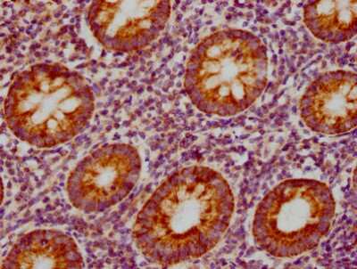 Immunohistochemistry: CCL19/MIP-3 beta Antibody (3A12) [NBP3-15143] - IHC image of CCL19/MIP-3 beta antibody diluted at 1:155 and staining in paraffin-embedded human appendix tissue. After dewaxing and hydration, antigen retrieval was mediated by high pressure in a citrate buffer (pH 6.0). Section was blocked with 10% normal goat serum 30 minutes at RT. Then primary antibody (1% BSA) was incubated at 4C overnight. The primary is detected by a biotinylated secondary antibody and visualized using an HRP conjugated SP system.