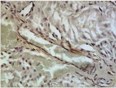 Immunohistochemistry-Paraffin: CCL21/6Ckine Antibody (RM0174-10K10) [NBP2-12104] - The Kidney tissue samples from the Folic Acid induced kidney injury model were fixed using 4% PFA at 4C for overnight and embeded in paraffin. 4um section was sublected to IHC with NBP2-12104