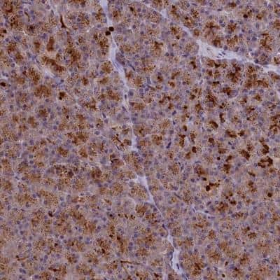 Immunohistochemistry: CCL23/Ck beta 8-1/MIP3 Antibody [NBP1-88079] - Staining of human pancreas shows strong cytoplasmic positivity in exocrine glandular cells.