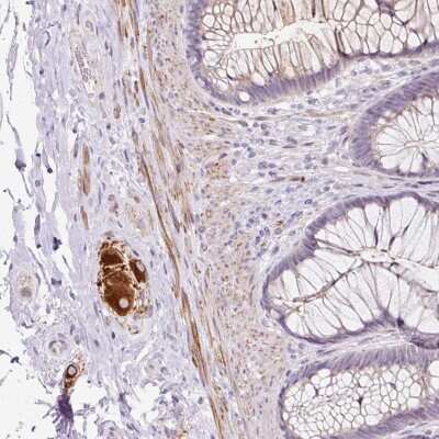 Immunohistochemistry: CCL25/TECK Antibody [NBP2-49199] - Staining of human rectum shows strong cytoplasmic positivity in peripheral ganglion.