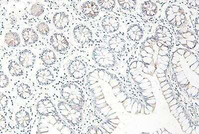 Immunohistochemistry-Paraffin: CCL25/TECK Antibody [NBP1-40993] - Normal human small bowel.