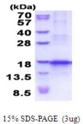 SDS-Page: Recombinant Human CCL25/TECK Protein [NBP2-52003] - 15% SDS Page (3 ug)