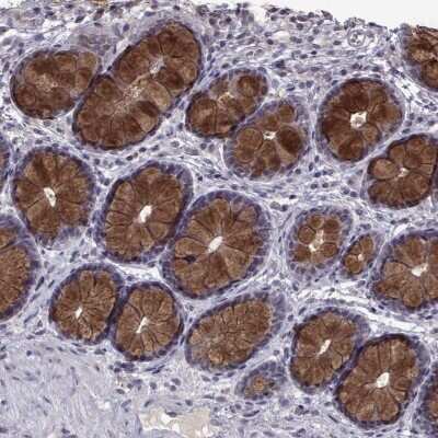 Immunohistochemistry-Paraffin: CCL28 Antibody [NBP2-69040] - Staining of human colon shows strong cytoplasmic positivity in glandular cells.