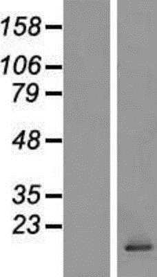 Western Blot: CCL28 Overexpression Lysate (Native) [NBL1-08855] - CCL28 Overexpression Lysate (Adult Normal) [NBL1-08855] Left-Empty vector transfected control cell lysate (HEK293 cell lysate); Right -Over-expression Lysate for CCL28.