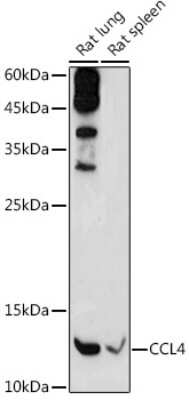 Western Blot: CCL4/MIP-1 beta Antibody [NBP3-05561] - Western blot analysis of extracts of various cell lines, using CCL4/MIP-1 beta antibody (NBP3-05561) at 1:1000 dilution. Secondary antibody: HRP Goat Anti-Rabbit IgG (H+L) at 1:10000 dilution. Lysates/proteins: 25ug per lane. Blocking buffer: 3% nonfat dry milk in TBST. Detection: ECL Basic Kit. Exposure time: 180s.