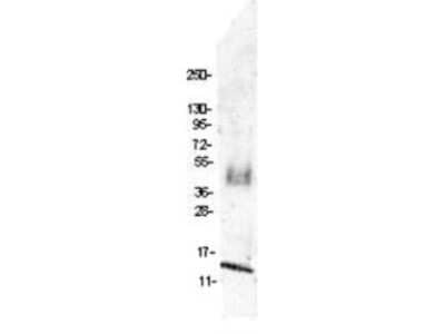 Western Blot: CCL4L1/LAG-1 Antibody [NBP1-77897] - Shows detection of recombinant swine MIP-1b (CCL4) raised in yeast. The protein was purified and resolved by SDS-PAGE, then transferred to PVDF membrane. Membrane was blocked with 3% BSA (BSA-30, diluted 1:10), and probed with 4ug/mL primary antibody overnight at 4C. After washing, membrane was probed with IRDye800 (TM) conjugated Goat Anti-Rabbit IgG at 1:20,000 for 45 min at room temperature.