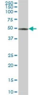 Western Blot: CCM2 Antibody [H00083605-B01P] - Analysis of CCM2 expression in human placenta.