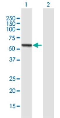 Western Blot: CCM2 Antibody [H00083605-B01P] - Analysis of CCM2 expression in transfected 293T cell line by CCM2 polyclonal antibody.  Lane 1: CCM2 transfected lysate(48.84 KDa). Lane 2: Non-transfected lysate.