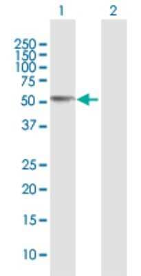 Western Blot: CCM2 Antibody [H00083605-D01P] - Analysis of CCM2 expression in transfected 293T cell line by CCM2 polyclonal antibody.Lane 1: CCM2 transfected lysate(48.80 KDa).Lane 2: Non-transfected lysate.