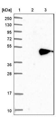 Western Blot: NOV/CCN3 Antibody [NBP1-88155] - CCN3 Antibody [NBP1-88155] - Lane 1: Marker [kDa] 250, 130, 95, 72, 55, 36, 28, 17, 10Lane 2: Negative control (vector only transfected HEK293T lysate)Lane 3: Over-expression lysate (Co-expressed with a C-terminal myc-DDK tag (~3.1 kDa) in mammalian HEK293T cells).