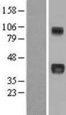 Western Blot: CCN3 Overexpression Lysate (Adult Normal) [NBL1-13729] Left-Empty vector transfected control cell lysate (HEK293 cell lysate); Right -Over-expression Lysate for CCN3.