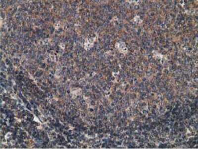 Immunohistochemistry-Paraffin: CCNB1IP1 Antibody (4H3) [NBP2-00600] - Staining of paraffin-embedded Human lymph node tissue using anti-CCNB1IP1 mouse monoclonal antibody.