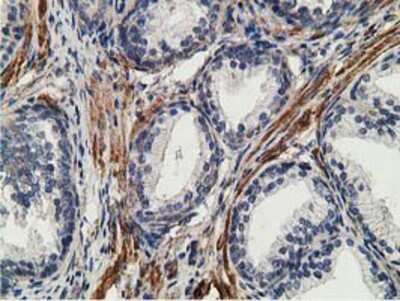 Immunohistochemistry-Paraffin: CCNB1IP1 Antibody (4H3) [NBP2-00600] Staining of paraffin-embedded Human prostate tissue using anti-CCNB1IP1 mouse monoclonal antibody.