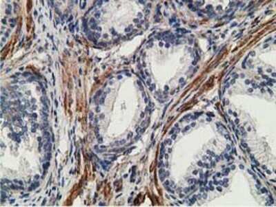 Immunohistochemistry: CCNB1IP1 Antibody (OTI4H3) - Azide and BSA Free [NBP2-72106] - Staining of paraffin-embedded Human prostate tissue using anti-CCNB1IP1 mouse monoclonal antibody.
