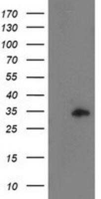 Western Blot: CCNB1IP1 Antibody (OTI4H3) - Azide and BSA Free [NBP2-72106] - HEK293T cells were transfected with the pCMV6-ENTRY control (Left lane) or pCMV6-ENTRY CCNB1IP1 (Right lane) cDNA for 48 hrs and lysed. Equivalent amounts of cell lysates (5 ug per lane) were separated by SDS-PAGE and immunoblotted with anti-CCNB1IP1.