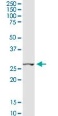 Western Blot: CCNB1IP1 Antibody [H00057820-D01P] - Analysis of CCNB1IP1 expression in mouse lung.